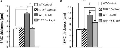 Preventing Peritoneal Dialysis-Associated Fibrosis by Therapeutic Blunting of Peritoneal Toll-Like Receptor Activity